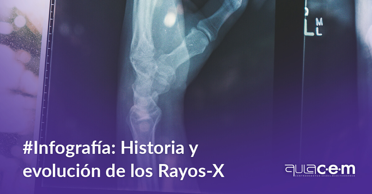 Historia y evolución de los Rayos X Aulacem